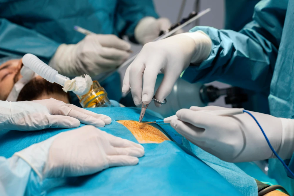 doctors doing surgical procedure patient